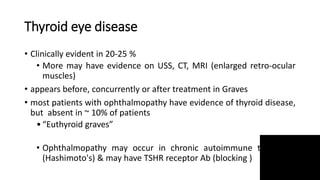 Thyroid eye disease
• Clinically evident in 20-25 %
• More may have evidence on USS, CT, MRI (enlarged retro-ocular
muscles)
• appears before, concurrently or after treatment in Graves
• most patients with ophthalmopathy have evidence of thyroid disease,
but absent in ~ 10% of patients
•“Euthyroid graves”
• Ophthalmopathy may occur in chronic autoimmune thyroiditis
(Hashimoto's) & may have TSHR receptor Ab (blocking )
 