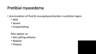 Pretibial myxoedema
• Accumulation of fluid & mucopolysaccharides in pretibial region
• Mild
• Severe
• Incapacitating
May appear as:
• Non pitting oedema
• Nodular
• Plaques
 