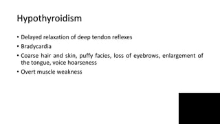 Hypothyroidism
• Delayed relaxation of deep tendon reflexes
• Bradycardia
• Coarse hair and skin, puffy facies, loss of eyebrows, enlargement of
the tongue, voice hoarseness
• Overt muscle weakness
 