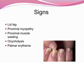 Signs
 Lid lag
 Proximal myopathy
 Proximal muscle
wasting
 Onycholysis
 Palmar erythema
 