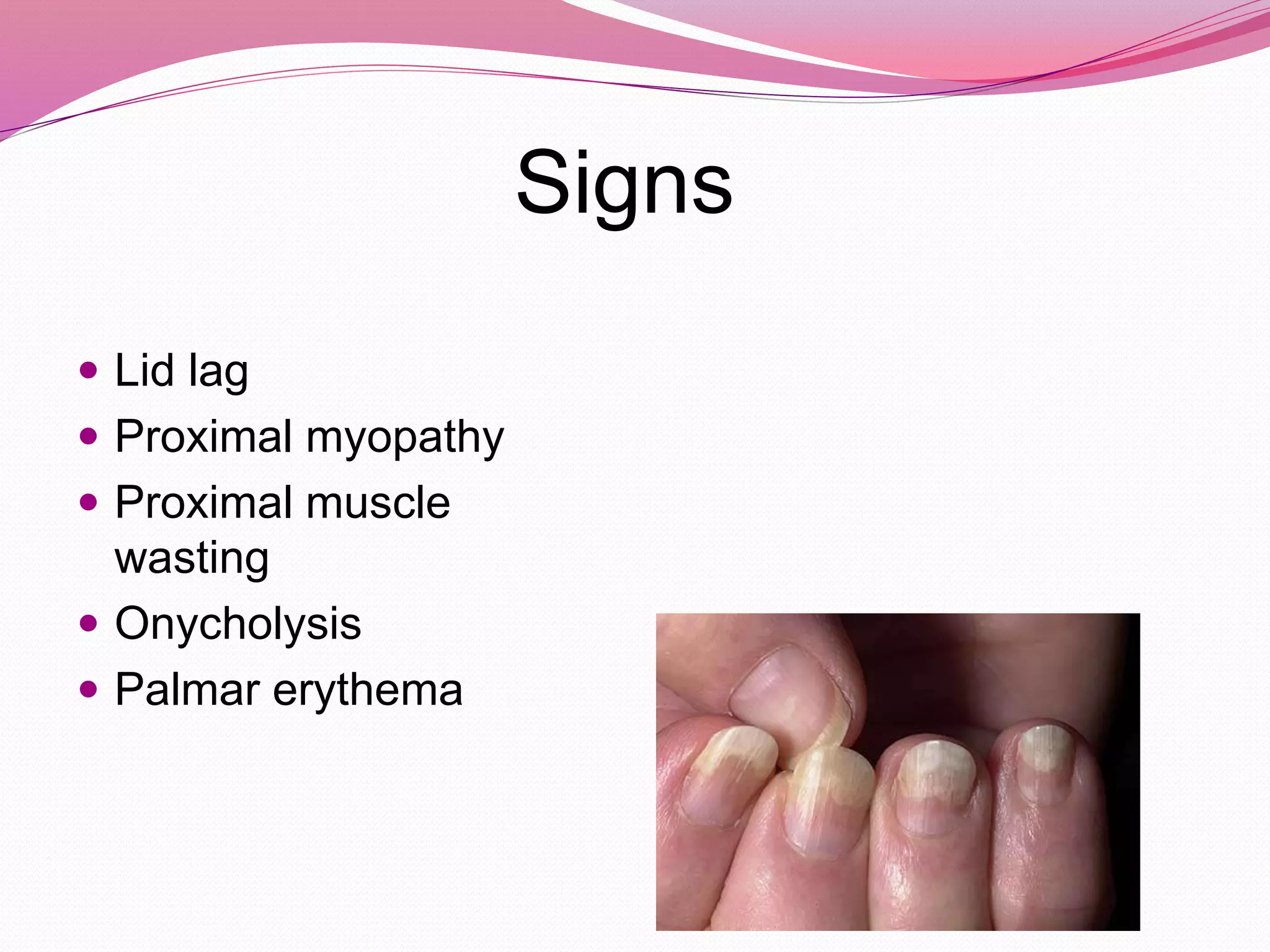 Signs
 Lid lag
 Proximal myopathy
 Proximal muscle
wasting
 Onycholysis
 Palmar erythema
 