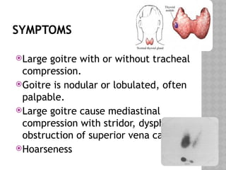 thyroid disorders PL DHIngra ear nose throat -.pptx