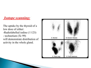 Isotope scanning:
The uptake by the thyroid of a
low dose of either:
-Radiolabelled iodine ( I 123)
- technetium (Tc 99)
will demonstrate distribution of
activity in the whole gland.
 