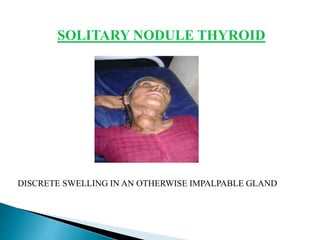 SOLITARY NODULE THYROID
DISCRETE SWELLING IN AN OTHERWISE IMPALPABLE GLAND
 