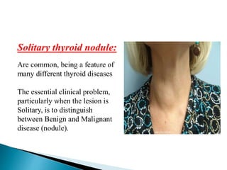 Solitary thyroid nodule:
Are common, being a feature of
many different thyroid diseases
The essential clinical problem,
particularly when the lesion is
Solitary, is to distinguish
between Benign and Malignant
disease (nodule).
 