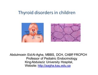 Thyroid disorders in children
Abdulmoein EidAl-Agha, MBBS, DCH, CABP, FRCPCH
Professor of Pediatric Endocrinology,
KingAbdulaziz University Hospital,
Website: http://aagha.kau.edu.sa
 