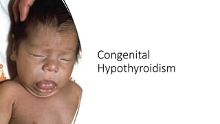 Congenital
Hypothyroidism
 