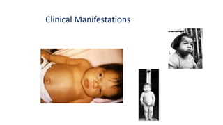 Clinical Manifestations
 