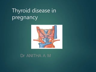 Thyroid disease in
pregnancy
Dr ANITHA A M
 