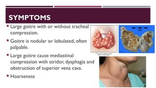 short presenatation on thyroid disorders | PPTX