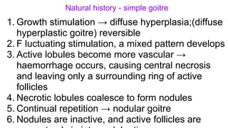 Natural history - simple goitre
1. Growth stimulation → diffuse hyperplasia;(diffuse
hyperplastic goitre) reversible
2. F luctuating stimulation, a mixed pattern develops
3. Active lobules become more vascular →
haemorrhage occurs, causing central necrosis
and leaving only a surrounding ring of active
follicles
4. Necrotic lobules coalesce to form nodules
5. Continual repetition → nodular goitre
6. Nodules are inactive, and active follicles are
 