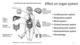 Effect on organ system
• Cardiovascular system
• Respiratory system
• Renal system
• Central nervous system
• Neuromuscular system
• Gastrointestinal system
• Hematology
19
 