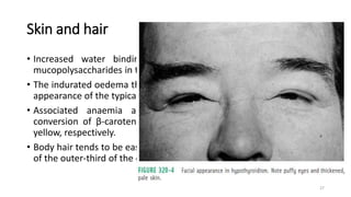 Skin and hair
• Increased water binding occurs as a result of deposition of
mucopolysaccharides in the skin, in common with the other tissues.
• The indurated oedema that results gives rise to the ‘myxoedematous’
appearance of the typical hypothyroid patient.
• Associated anaemia and hypercarotenaemia through impaired
conversion of β-carotene into retinol may render the skin pale or
yellow, respectively.
• Body hair tends to be easily lost, though the classic description of loss
of the outer-third of the eyebrows is rarely seen.
27
 