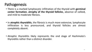 Pathogenesis
• There is a marked lymphocytic infiltration of the thyroid with germinal
center formation, atrophy of the thyroid follicles, absence of colloid,
and mild to moderate fibrosis.
• In atrophic thyroiditis, the fibrosis is much more extensive, lymphocyte
infiltration is less pronounced, and thyroid follicles are almost
completely absent.
• Atrophic thyroiditis likely represents the end stage of Hashimoto's
thyroiditis rather than a distinct disorder.
44
 