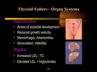 Thyroid Failure - Organ Systems 
Reproductive 
• Arrest of pubertal development 
• Reduced growth velocity 
• Menorrhagia, Amenorrhea 
• Anovulation, Infertility 
Hepatic 
• Increased LDL / TC 
• Elevated LDL + triglycerides 
20 
 
