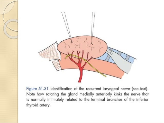subtotal thyroidectomy