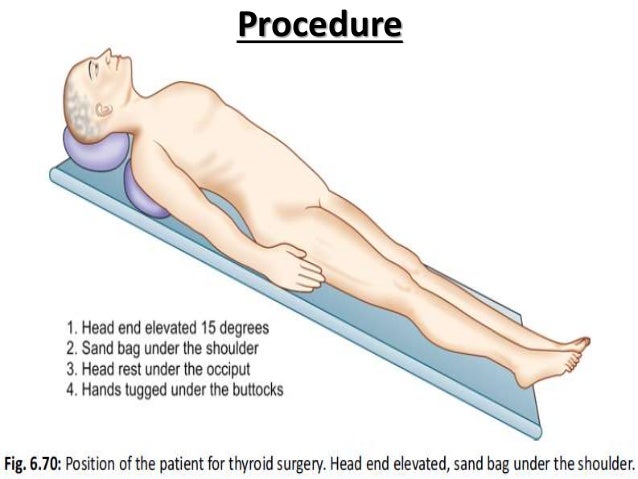 thyroidectomy
