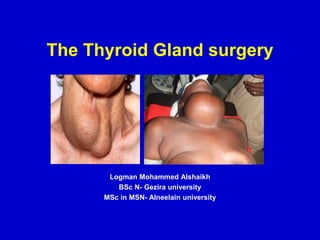 The Thyroid Gland surgery
Logman Mohammed Alshaikh
BSc N- Gezira university
MSc in MSN- Alneelain university
 