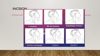 Lahey Incision Thyroidectomy presentation for medical students | PPTX