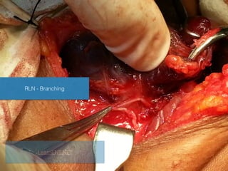 RLN - Branching
LearnENT.NET
 