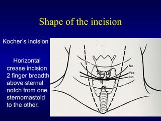 Types and technique of Thyroidectomy lecture.ppt