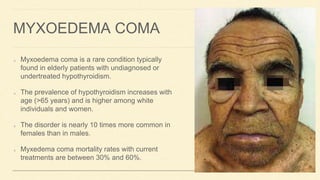 MYXOEDEMA COMA
Myxoedema coma is a rare condition typically
found in elderly patients with undiagnosed or
undertreated hypothyroidism.
The prevalence of hypothyroidism increases with
age (>65 years) and is higher among white
individuals and women.
The disorder is nearly 10 times more common in
females than in males.
Myxedema coma mortality rates with current
treatments are between 30% and 60%.
 