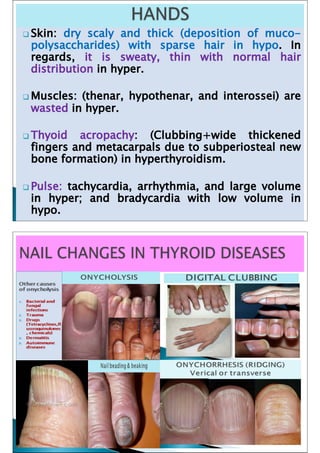 Skin Manifestations of Thyroid Disorders: A Review - Dermatology Advisor