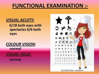PROPTOSIS EXAMINATION
• Signs checked for bilateral buldging of eyes

• Dalrymples Sign:- +ve
(This is stare due to retrac...