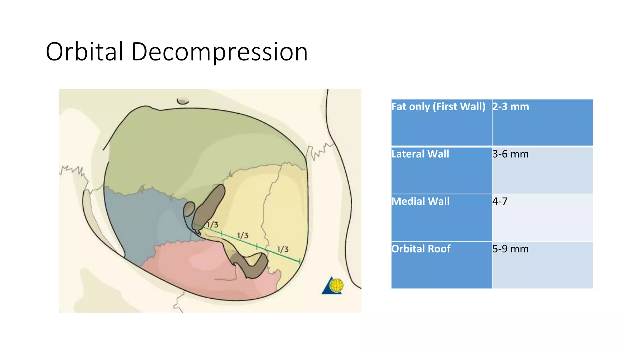Thyroid eye disease ( Graves Ophthalmopathy ) | PPTX