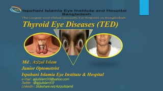Thyroid Eye Diseases (TED)
Md . Azizul Islam
Junior Optometrist
Ispahani Islamia Eye Institute & Hospital
IIEI&H
e-mail : ajijulislam513@yahoo.com
Twitter : @ajijulislam513
LinkedIn : Slideshare.net/AzizulIslam6
 