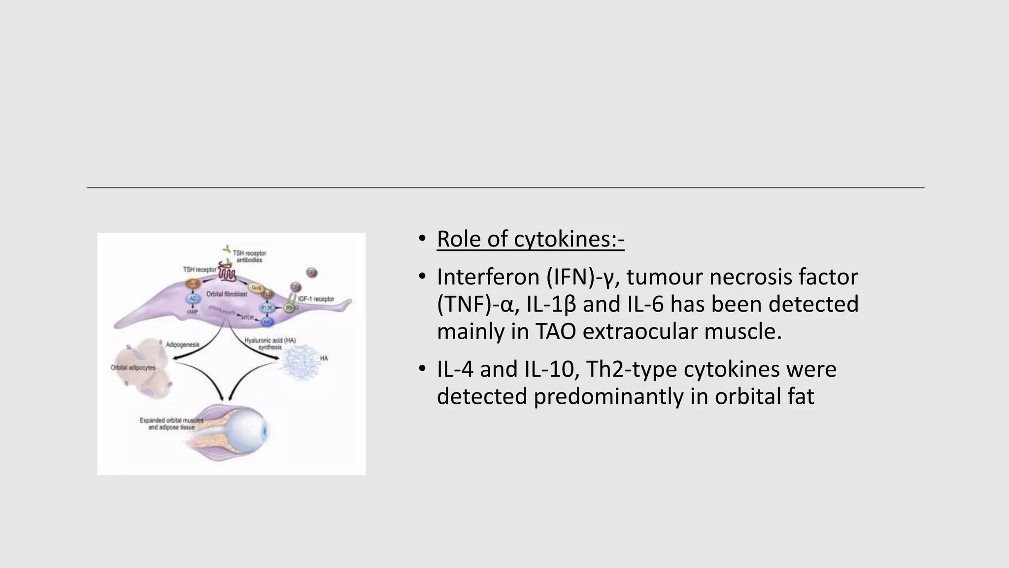 Thyroid eye disease | PPTX