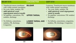 Thyroid eye disease of ophthalmology.pptx