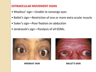 EXTRAOCULAR MOVEMENT SIGNS
• Moebius’ sign—Unable to converge eyes
• Ballet’s sign—Restriction of one or more extra ocular muscle
• Suker’s sign—Poor fixation on abduction
• Jendrassik’s sign—Paralysis of all EOMs.
MOEBIUS’ SIGN BALLET’S SIGN
 