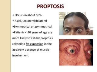 PROPTOSIS
• Occurs in about 50%
• Axial, unilateral/bilateral
•Symmetrical or asymmetrical
•Patients < 40 years of age are
more likely to exhibit proptosis
related to fat expansion in the
apparent absence of muscle
involvement
 