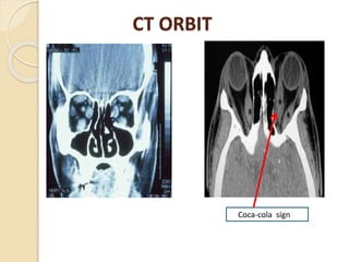 CT ORBIT
Coca-cola sign
 