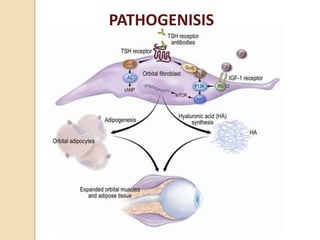 PATHOGENISIS
 