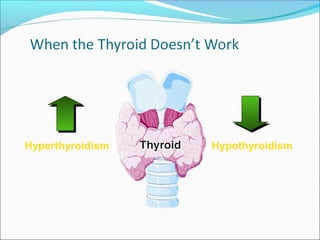 Hyperthyroidism   Hypothyroidism
 