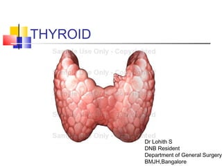 THYROID
Dr Lohith S
DNB Resident
Department of General Surgery
BMJH,Bangalore
 
