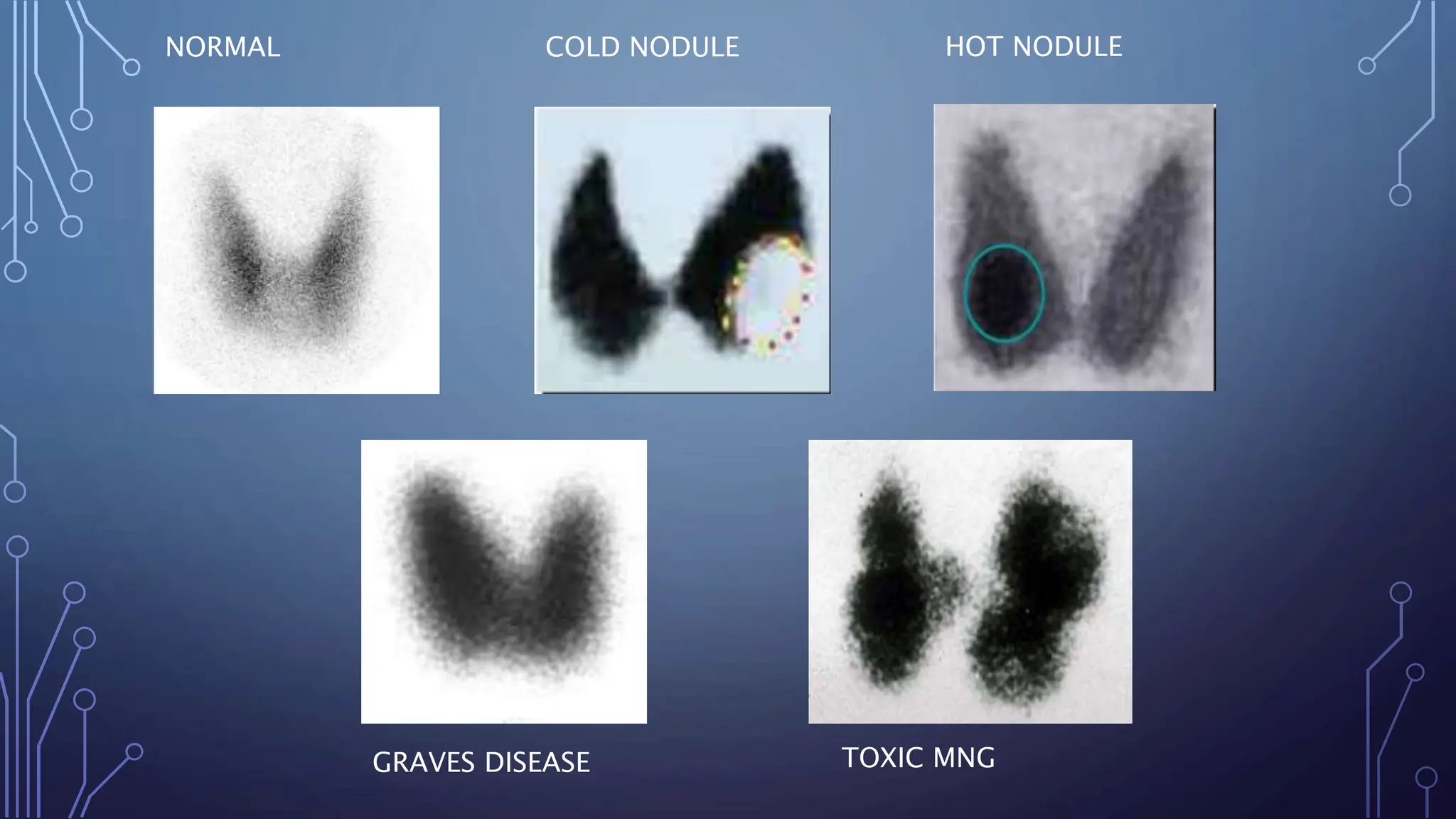 THYROID FUNCTION TEST | PPTX
