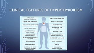 CLINICAL FEATURES OF HYPERTHYROIDISM
 