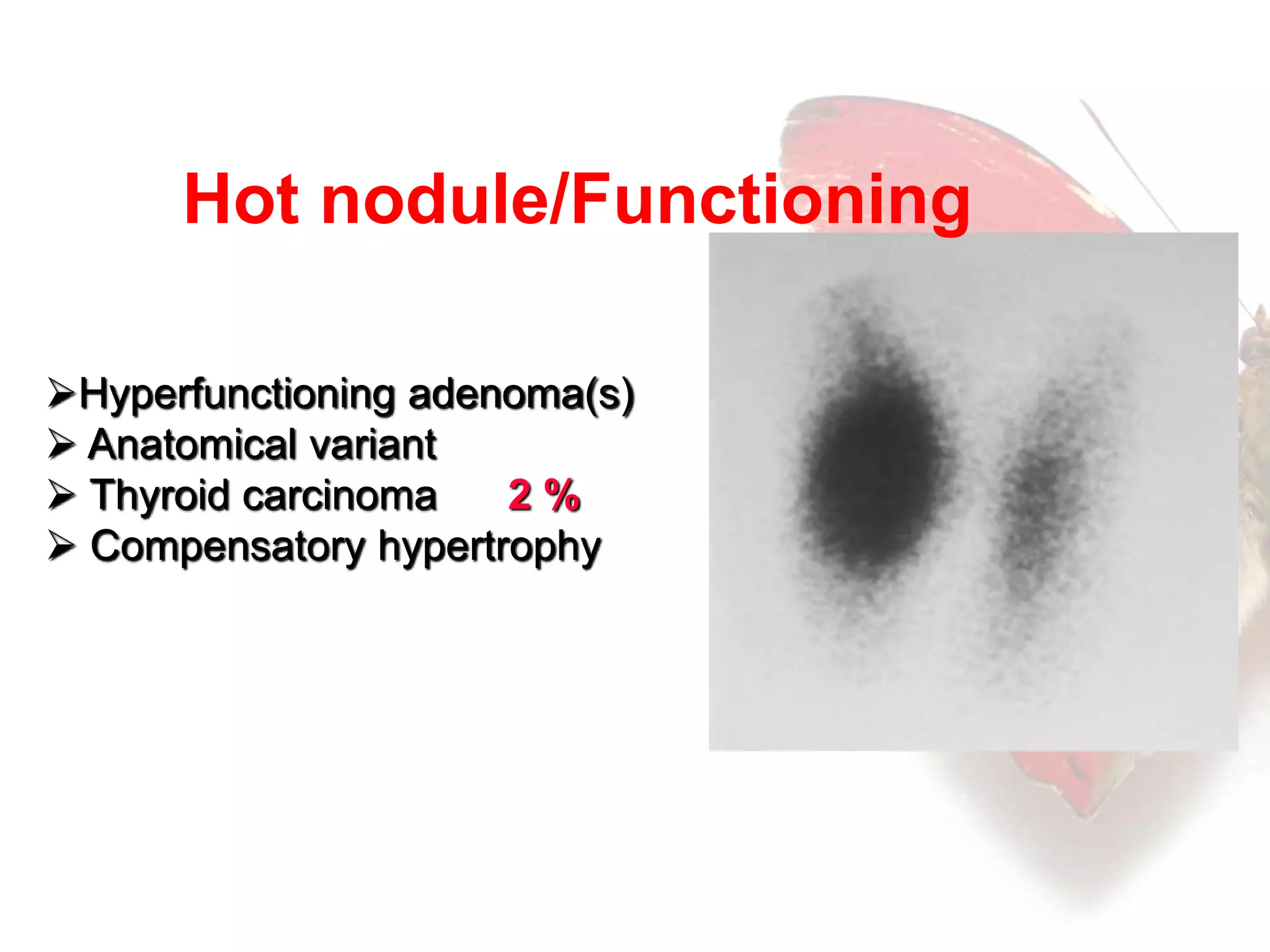 Thyroid function tests | PPTX