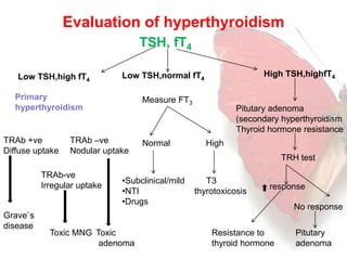 Evaluation of hyperthyroidism 
TSH, fT4 
Low TSH,high fT4 Low TSH,normal fT4 
High TSH,highfT4 
Primary 
hyperthyroidism 
TRAb +ve 
Diffuse uptake 
TRAb –ve 
Nodular uptake 
TRAb-ve 
Irregular uptake 
Grave`s 
disease 
Toxic 
adenoma 
Toxic MNG 
Measure FT3 
Normal High 
T3 
thyrotoxicosis 
•Subclinical/mild 
•NTI 
•Drugs 
Pitutary adenoma 
(secondary hyperthyroidism 
Thyroid hormone resistance 
TRH test 
response 
Resistance to 
thyroid hormone 
No response 
Pitutary 
adenoma 
 