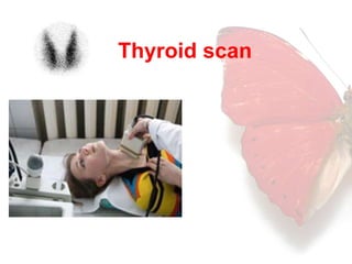 Thyroid scan 
 