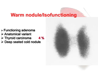 Warm nodule/Isofunctioning 
 Functioning adenoma 
 Anatomical variant 
 Thyroid carcinoma 4 % 
 Deep seated cold nodule 
 