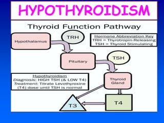 HYPOTHYROIDISM
 