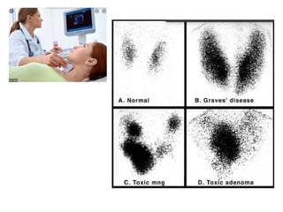 Thyroid Function Test Thyroid Hormones Pptx