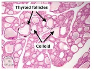 Thyroid gland