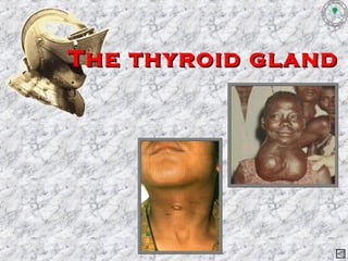 The thyroid glandThe thyroid gland
 