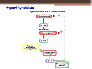 Hyperthyroidism
 