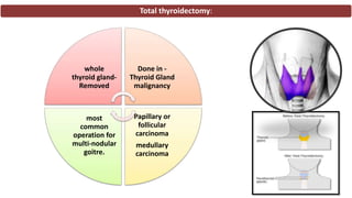 Thyroidectomy | PPTX
